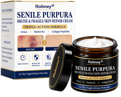 🇦🇺🎁👩‍⚕️Rolimey® BruiseRepair & Skin-Strengthening Cream-Advanced daily care forbruise-prone skin
