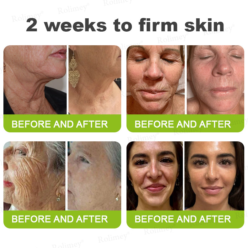 🍈Made and shipped from Australia 💫Rolimey® Botox & Vita-A Retinol Shot Wrinkle-Lift Tightening cream - Last Day Promotion 70% OFF