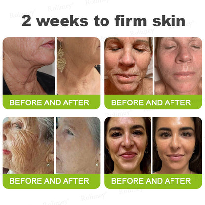 🍈Made and shipped from Australia 💫Rolimey® Botox & Vita-A Retinol Shot Wrinkle-Lift Tightening cream - Last Day Promotion 70% OFF