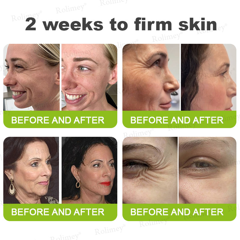 🍈Made and shipped from Australia 💫Rolimey® Botox & Vita-A Retinol Shot Wrinkle-Lift Tightening cream - Last Day Promotion 70% OFF