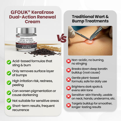 🔥Last Day 70% OFF🔥GFOUK® KeraErase Dual-Action Renewal Cream