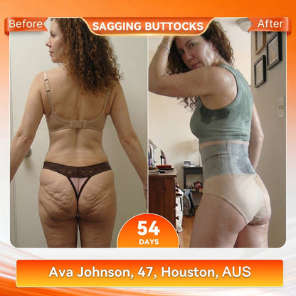 🇦🇺𝐎𝐟𝐟𝐢𝐜𝐢𝐚𝐥 𝐁𝐫𝐚𝐧𝐝 𝐒𝐭𝐨𝐫𝐞 |👗 GFOUK® 𝟐𝟎𝟐𝟔 𝐌𝐨𝐫𝐢𝐧𝐠𝐚 & 𝐁𝐞𝐫𝐛𝐞𝐫𝐢𝐧𝐞 𝟒-𝐈𝐧-𝟏 𝐌𝐢𝐜𝐫𝐨-𝐏𝐚𝐫𝐭𝐢𝐜𝐥𝐞 𝐒𝐜𝐮𝐥𝐩𝐭𝐢𝐧𝐠 & 𝐅𝐚𝐭-𝐁𝐮𝐫𝐧 𝐒𝐡𝐨𝐫𝐭𝐬👍
