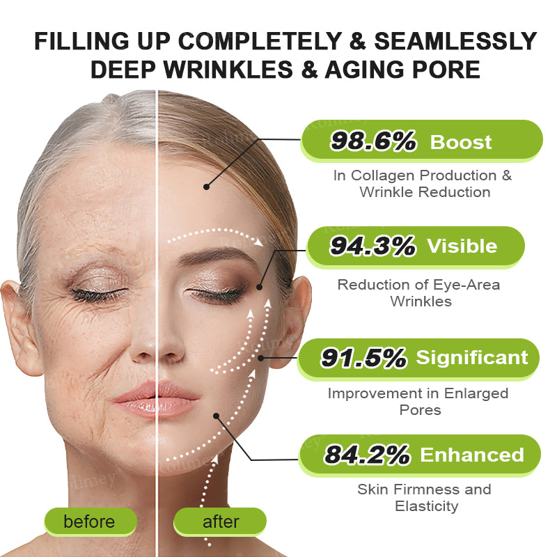 🍈Made and shipped from Australia 💫Rolimey® Botox & Vita-A Retinol Shot Wrinkle-Lift Tightening cream - Last Day Promotion 70% OFF