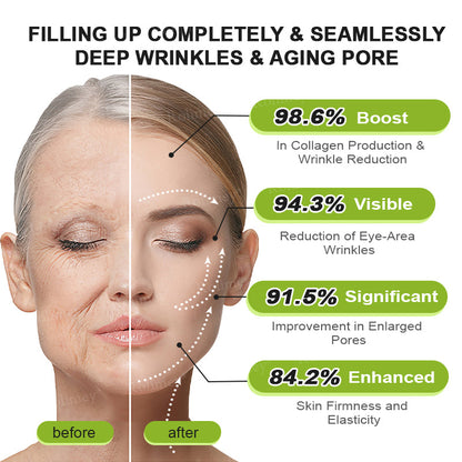 🍈Made and shipped from Australia 💫Rolimey® Botox & Vita-A Retinol Shot Wrinkle-Lift Tightening cream - Last Day Promotion 70% OFF