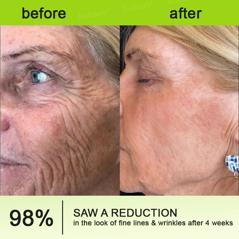 🍈Made and shipped from Australia 💫Rolimey® Botox & Vita-A Retinol Shot Wrinkle-Lift Tightening cream - Last Day Promotion 70% OFF