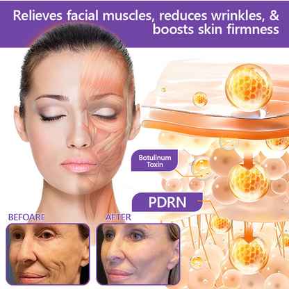 🔥Made and shipped from Australia 💫Rolimey® PDRN Multi-Peptide Massaging Roller Cream - Anti-aging, Hydrating, Skin Firming & Lifting, Skin Repair, Even Tone, Acne and Dark Spot Treatment, Wart and Mole Removal, and Psoriasis Relief.