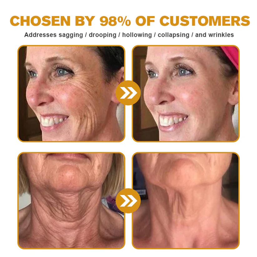 🍇Made and Shipped from Australia✨✨ : Rolimey® Bee venom Pro Comprehensive Cream — 🔥Limited Time 80% OFF🔥