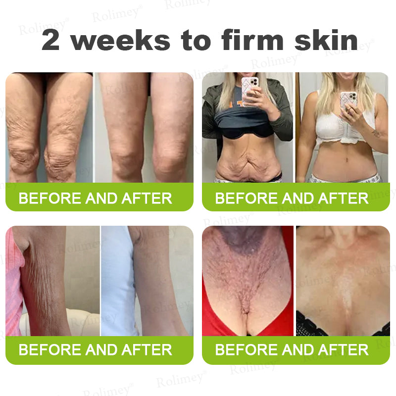 🍈Made and shipped from Australia 💫Rolimey® Botox & Vita-A Retinol Shot Wrinkle-Lift Tightening cream - Last Day Promotion 70% OFF