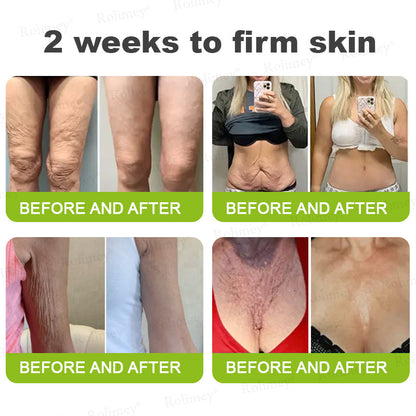 🍈Made and shipped from Australia 💫Rolimey® Botox & Vita-A Retinol Shot Wrinkle-Lift Tightening cream - Last Day Promotion 70% OFF