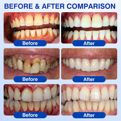 🛡️🦷Evolvion® GumVital Advanced Gum Care Gel🛡️🎁