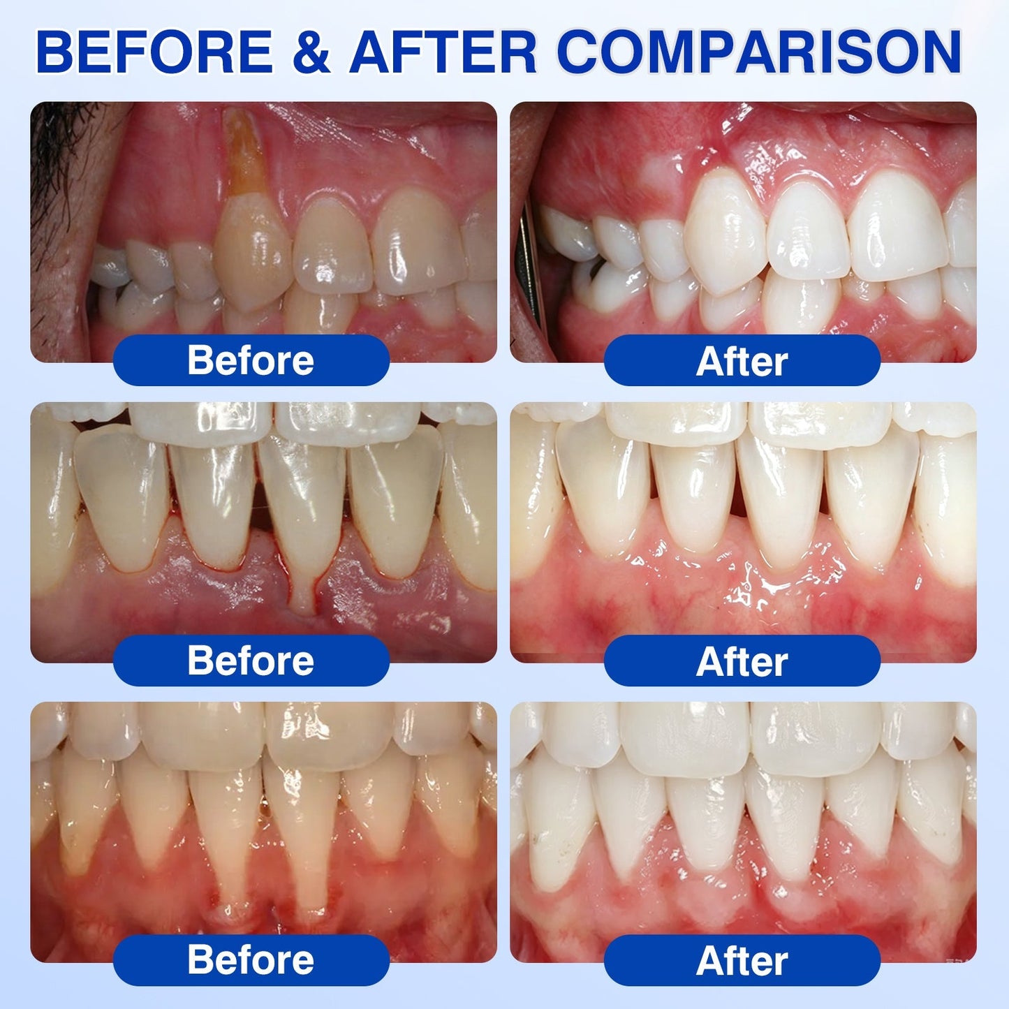🛡️🦷Evolvion® GumVital Advanced Gum Care Gel🛡️🎁