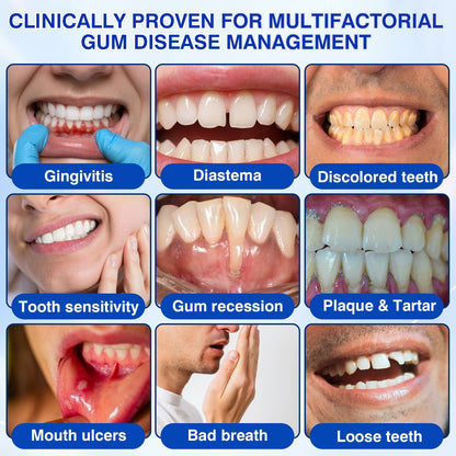 🛡️🦷Evolvion® GumVital Advanced Gum Care Gel🛡️🎁