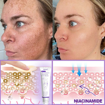 🔥Made and shipped from Australia 💫Rolimey® PDRN Multi-Peptide Massaging Roller Cream - Anti-aging, Hydrating, Skin Firming & Lifting, Skin Repair, Even Tone, Acne and Dark Spot Treatment, Wart and Mole Removal, and Psoriasis Relief.