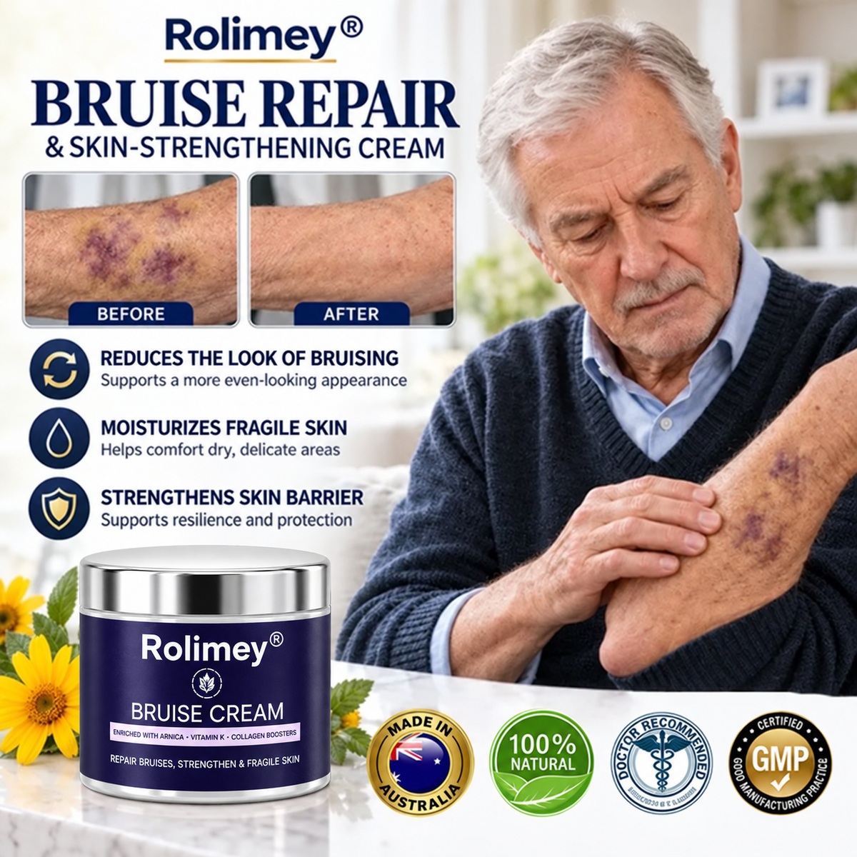 🇦🇺🌟👩‍⚕️Rolimey® BruiseRepair & Skin-Strengthening Cream-Advanced daily care forbruise-prone skin