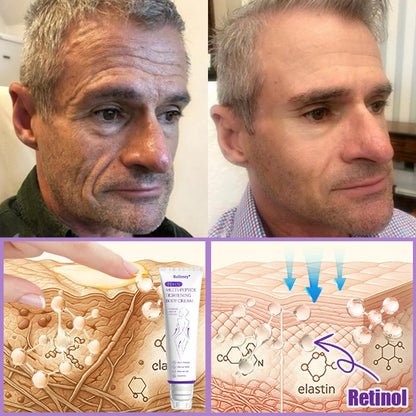 🔥Made and shipped from Australia 💫Rolimey® PDRN Multi-Peptide Massaging Roller Cream - Anti-aging, Hydrating, Skin Firming & Lifting, Skin Repair, Even Tone, Acne and Dark Spot Treatment, Wart and Mole Removal, and Psoriasis Relief.