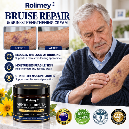 🇦🇺🎁👩‍⚕️Rolimey® BruiseRepair & Skin-Strengthening Cream-Advanced daily care forbruise-prone skin