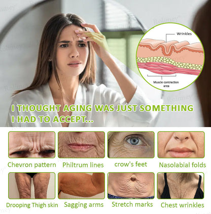 🍈Made and shipped from Australia 💫Rolimey® Botox & Vita-A Retinol Shot Wrinkle-Lift Tightening cream - Last Day Promotion 70% OFF