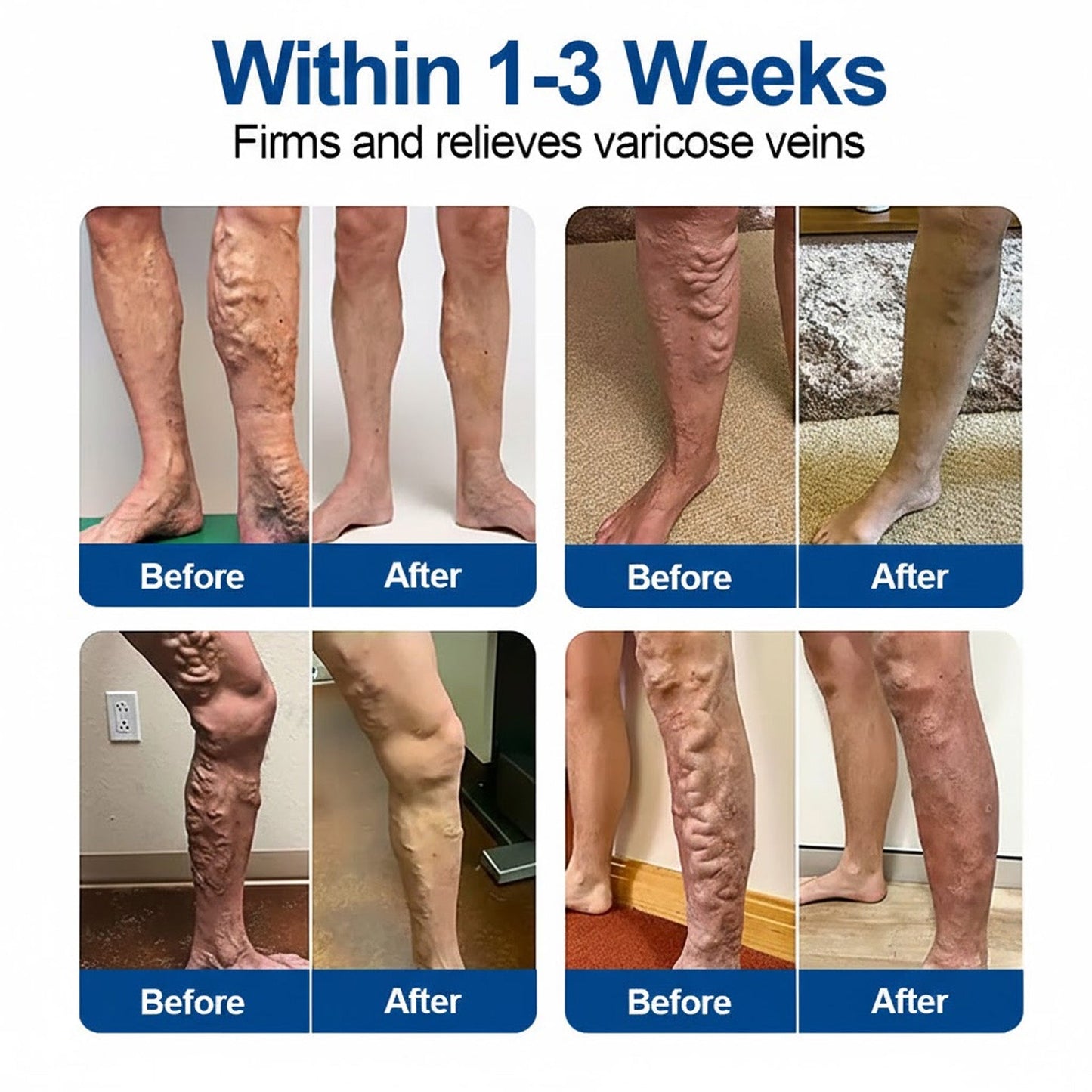 🇦🇺👨‍⚕️✅GFOUK® VeinEase Microneedle Care Patch⚡Instant Relief, Long-Term Results