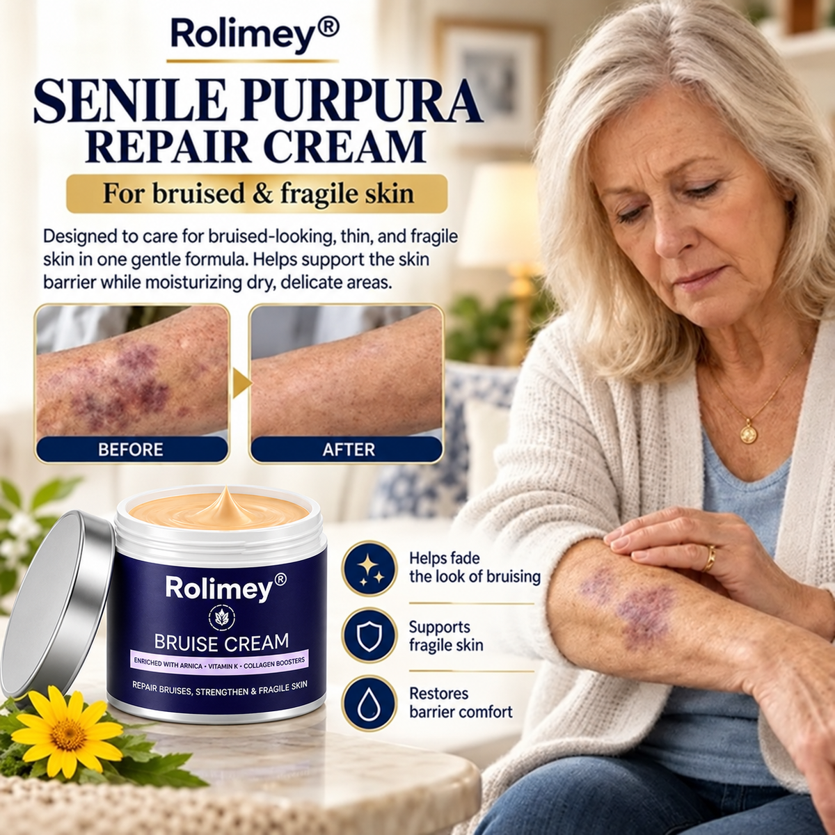 🇦🇺🌟👩‍⚕️Rolimey® BruiseRepair & Skin-Strengthening Cream-Advanced daily care forbruise-prone skin
