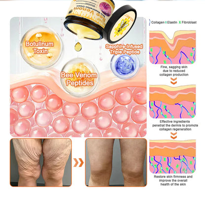 🍇Made and Shipped from Australia✨✨ : Rolimey® Bee venom Pro Comprehensive Cream — 🔥Limited Time 80% OFF🔥