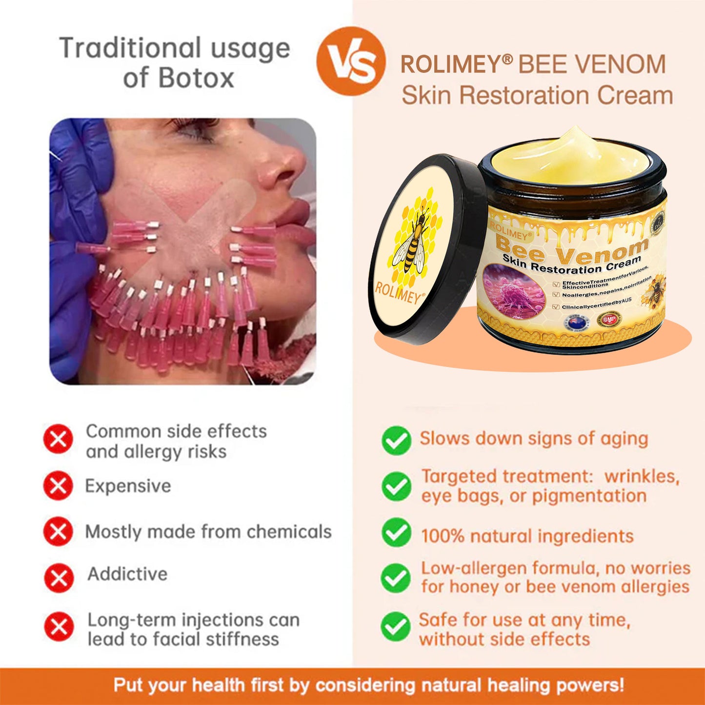 🍇Made and Shipped from Australia✨✨ : Rolimey® Bee venom Pro Comprehensive Cream — 🔥Limited Time 80% OFF🔥