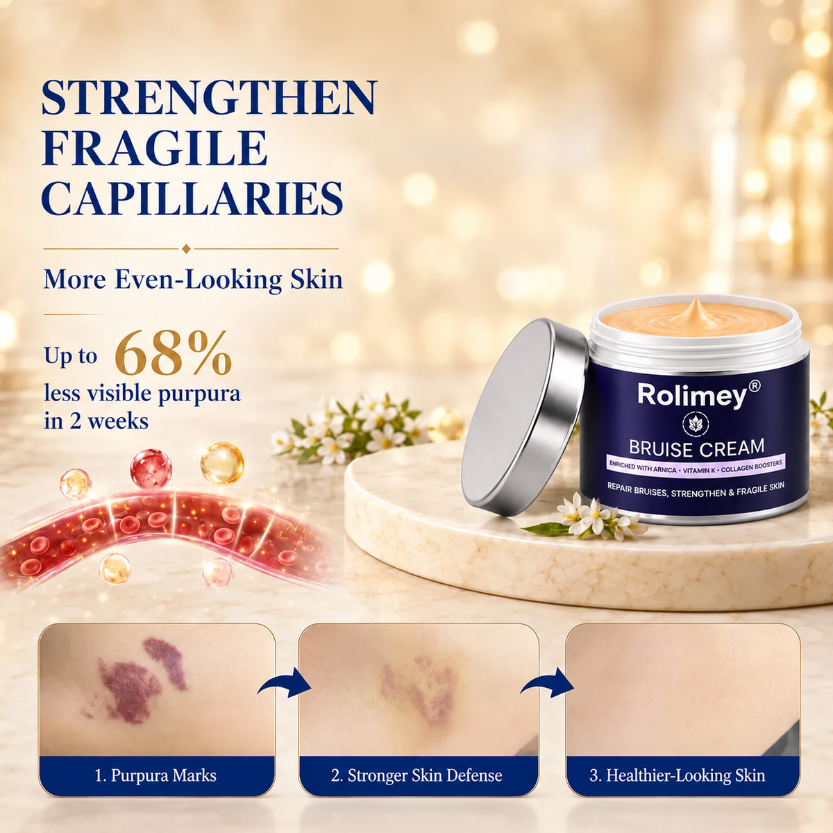 🇦🇺🌟👩‍⚕️Rolimey® BruiseRepair & Skin-Strengthening Cream-Advanced daily care forbruise-prone skin