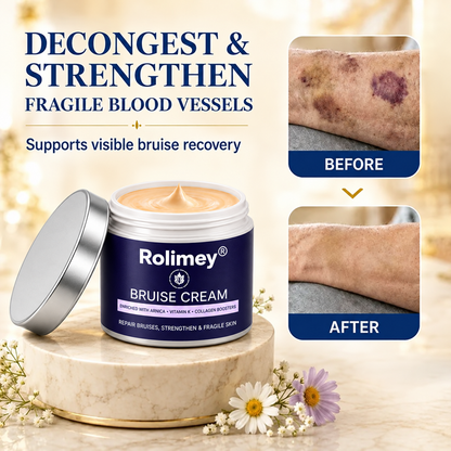 🇦🇺🌟👩‍⚕️Rolimey® BruiseRepair & Skin-Strengthening Cream-Advanced daily care forbruise-prone skin