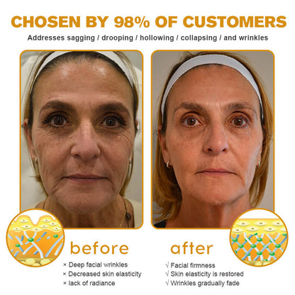 (🐝Made and Shipped from Australia✅) Furzero™ Botox Bee Venom Wrinkle Removal Cream- LAST DAY 70% OFF
